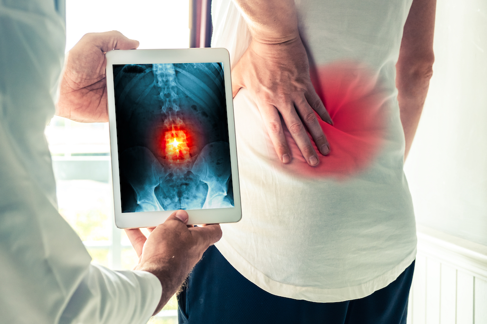 doctor gives the result of the Spine X-ray on his patient